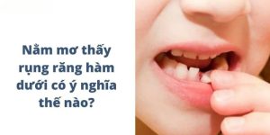 nằm mơ thấy rụng răng hàm dưới