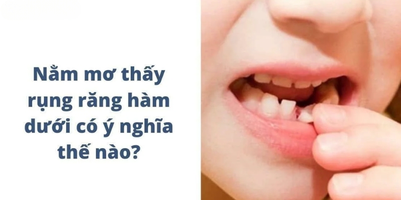 nằm mơ thấy rụng răng hàm dưới