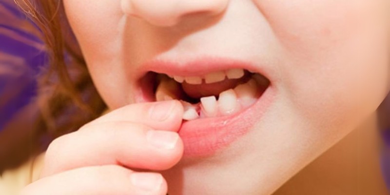 Ý nghĩa của việc nằm mơ thấy rụng răng hàm dưới cần phải biết